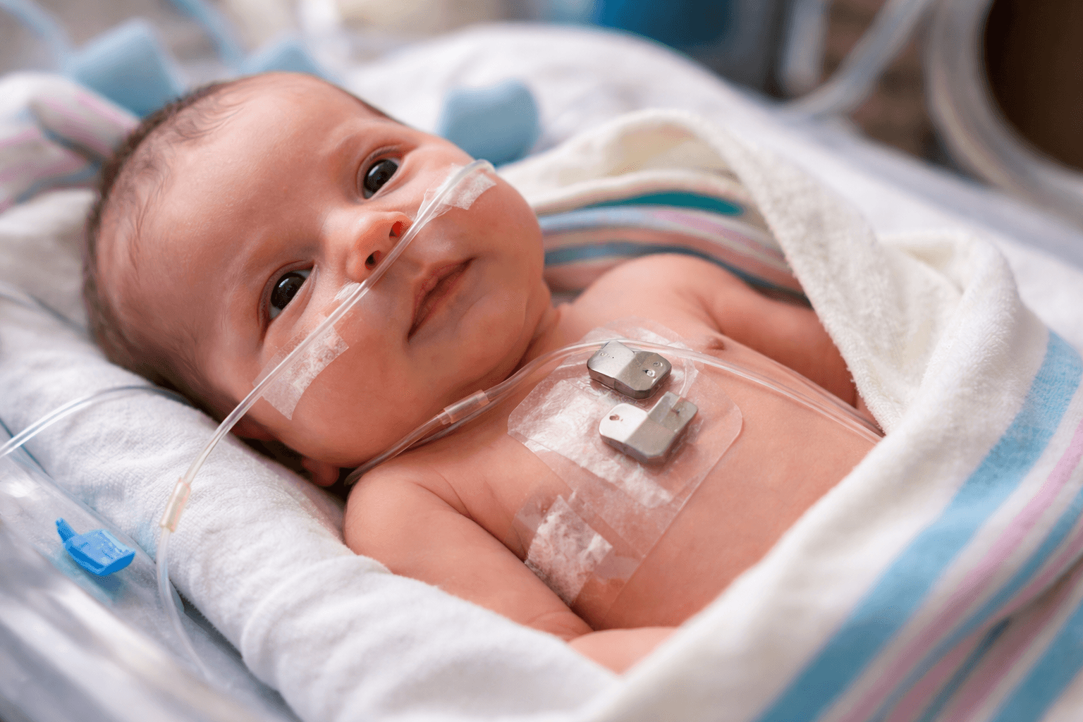 First Tiny Pacemaker Marks Historic Advance in Newborn Heart Treatment